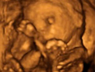 Cara de feto de 18 semanas