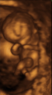 desarrollo feto mes