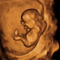 Bebé en el útero: semana 12 de embarazo
