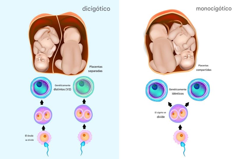 Los riesgos de los embarazo de gemelos en mujeres mayores