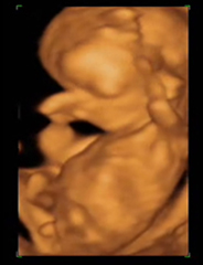 Desarrollo del feto semana 17