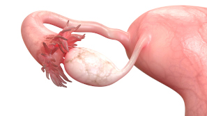 Cómo preservar tejido ovárico en niñas con cáncer