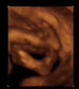 Desarrollo del feto sexto mes