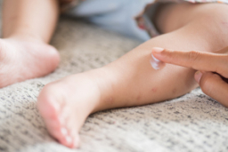 Se triplican los casos de bebés con sarampión en el mundo