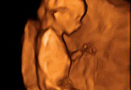 Ecografía 3d De La Semana 11 Feto De Perfil