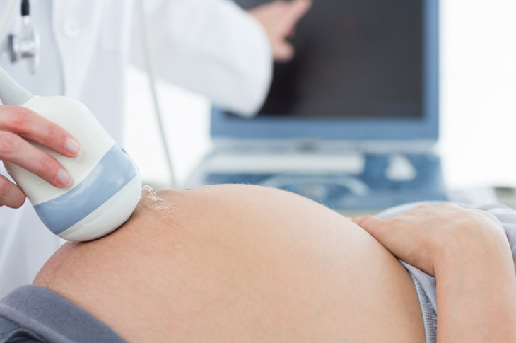 Para qué sirve la ecografía doppler en el embarazo? - Ginefem