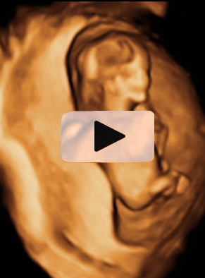 Ecografía 4D de un feto de espaldas	