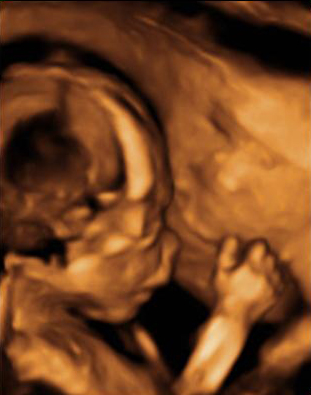 Cara de perfil de bebé de 20 semanas de gestación