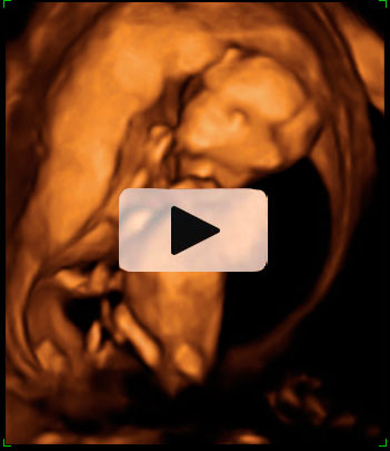 Ecografía en 4D de un feto de 12 semanas