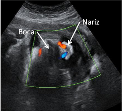 respiracion fetal