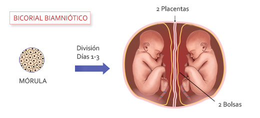 Bicorial biamniótico
