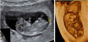 Desarrollo del feto semana 10