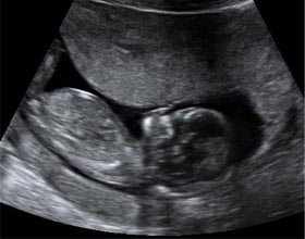 Embarazo semana 13: Órganos del casi formados -