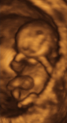 desarrollo feto segundo mes