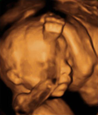 Bebé de 21 semanas tapándose los ojos