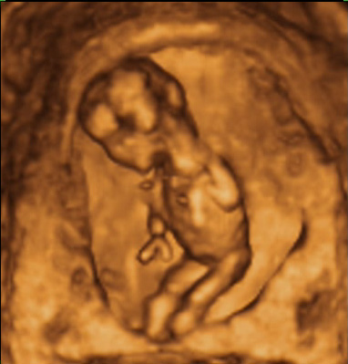 Desarrollo del feto semana 13