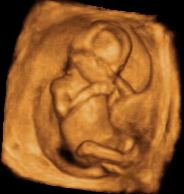 Ecografía 3D de un feto de 15 semanas