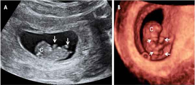 Desarrollo del feto semana 9