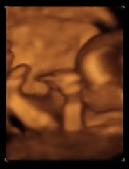 Ecografía 4D de un feto de 14 semanas