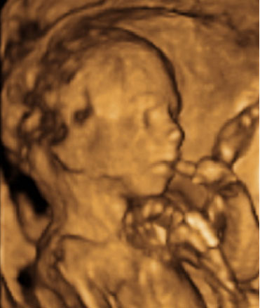 Ecografía 4D de un feto de 20 semanas