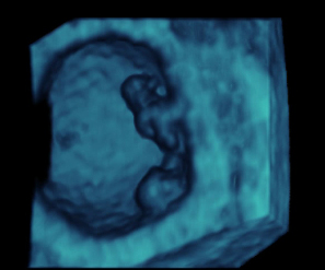 7 semanas feto: ecografía cómo es