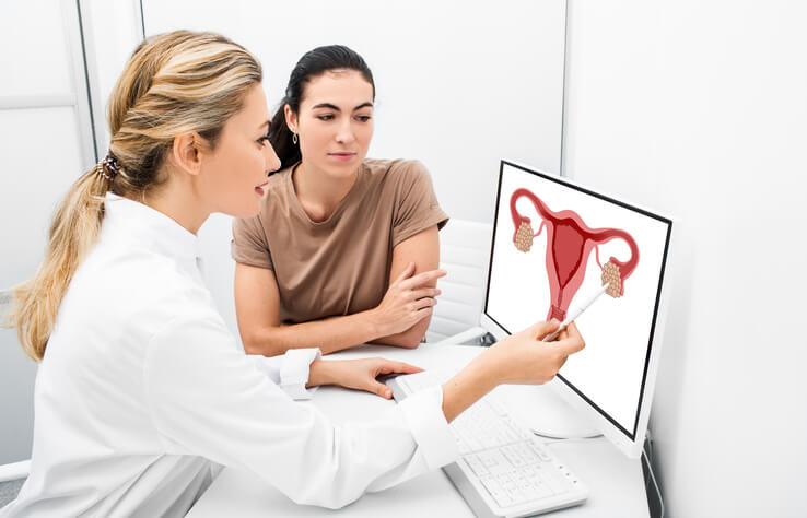 endometrio fiino, qué es, causas y tratamiento