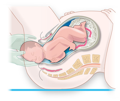 comestible Enciclopedia longitud Embarazo semana 40: A urgencias si estás de parto - Natalben