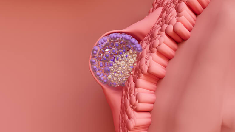 Los síntomas de la implantación del embrión