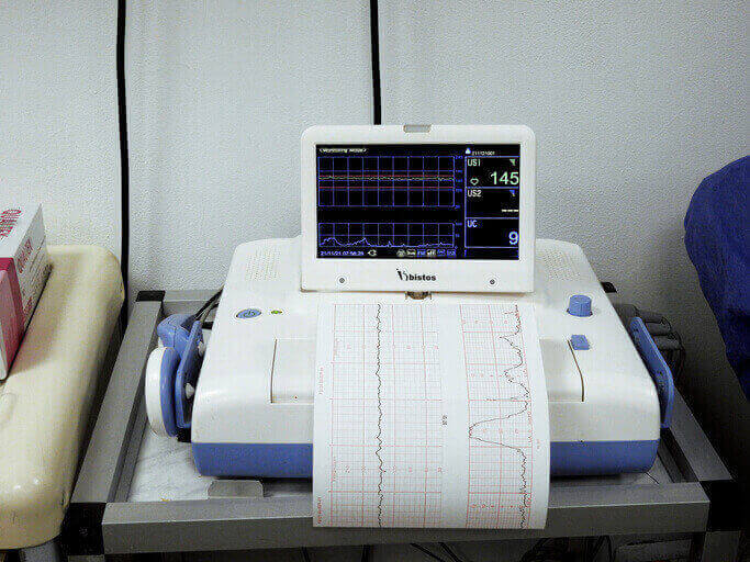 Cardiotocografo en el parto y en el embarazo
