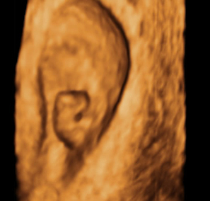 Órganos semana 7 del bebé: brazos y piernas