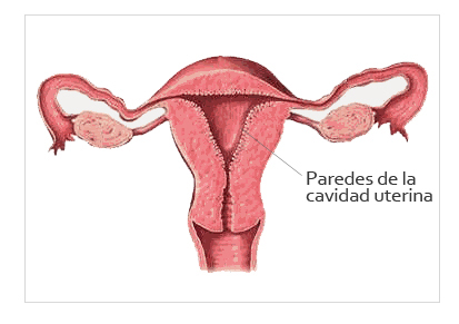 paredes utero