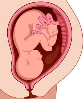 La placenta en el embarazo