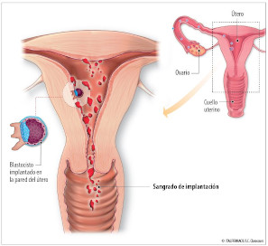 Qué es el sangrado de implantación de la gestante