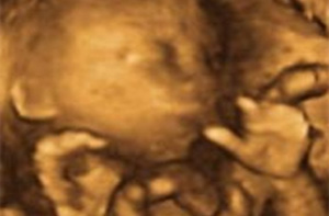 ecografia de un feto de 19 semanas