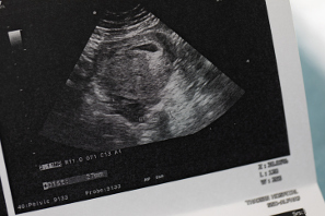 Síntomas de embarazo: todas las curiosidades