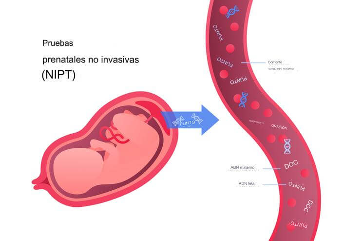 El test de adn fetal en sangre materna