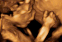 Ecografía semana 20 - Bebé de perfil y pared del útero