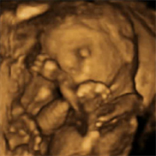 Desarrollo del feto semana 17 de embarazo