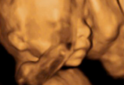 Ecografía 3D bebé tapándose la cara con ambos brazos
