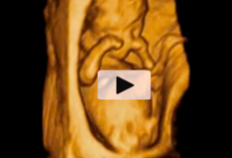 Ecografía 3D de un feto de 12 semanas en rotación