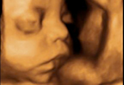 Ecografía 3D tercer trimestre embarazo - Cara y mano fetales
