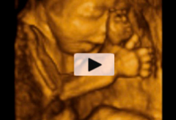 Ecografía 4D tercer trimestre - Cara y cuerpo de un feto