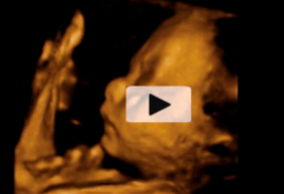 Ecografía 4D tercer trimestre embarazo - Feto de 29 semanas