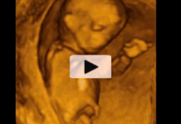 Ecografía: feto de 11 semanas moviéndose en el útero materno