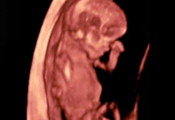 Perfil en ecografía 3D de un feto de 11 semanas