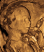 Desarrollo del feto semana 20 de embarazo