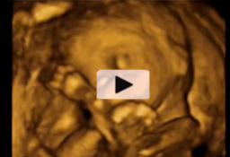 Ecografía 4D - Cara de un feto de 18 semanas