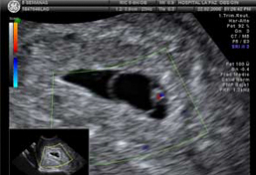 Ecografías de todas las etapas del Embarazo: 2D, 3D y 4D
