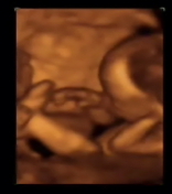 Desarrollo fetal cuarto mes