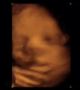 Desarrollo fetal octavo mes